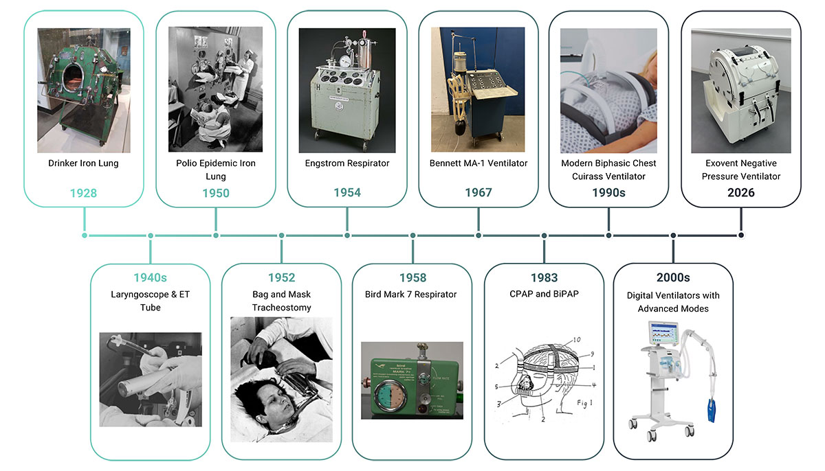 Ventilator History